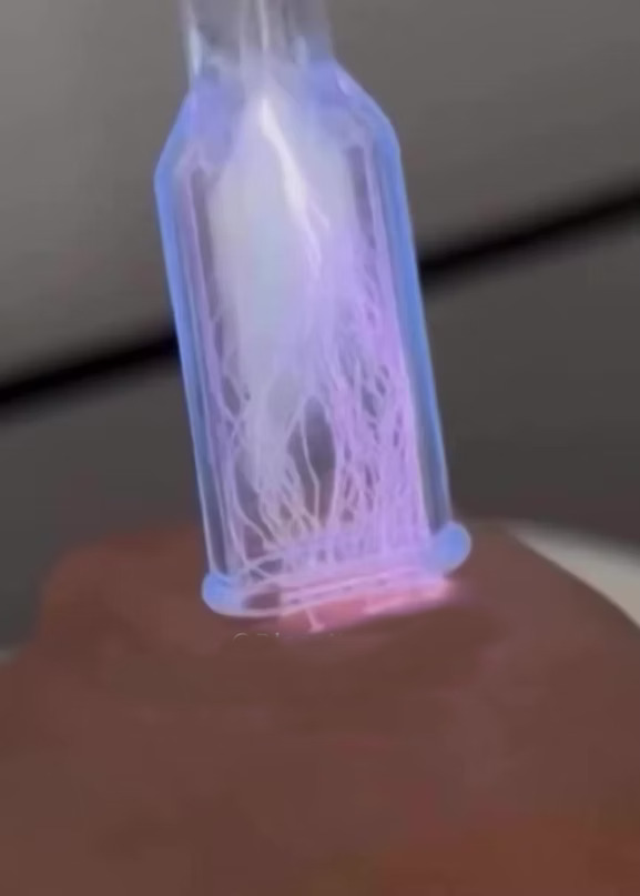 Hydraglow Macro microneedling treatment